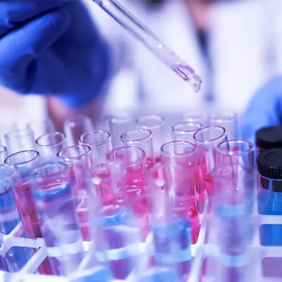 amino acids quantitative, urine and plasma 45 amino acids/full panel